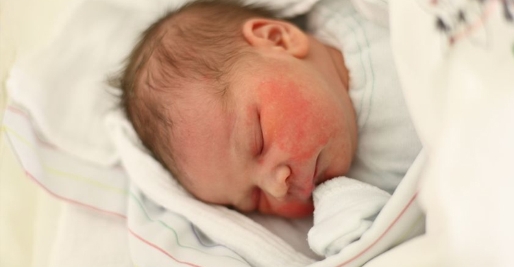 認識「胎脂」，寶寶最天然的肌膚保護層！