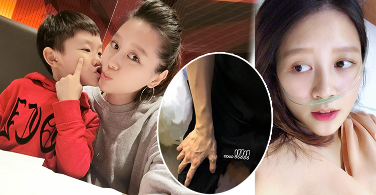 嚴立婷憂早產臥床安胎，滿手爆青筋自嘲男人手