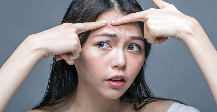 女性青春痘狂冒，因為內分泌失調？