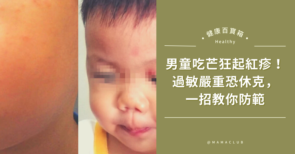 男童吃完芒果狂起紅疹！過敏嚴重恐休克，一招教你防範