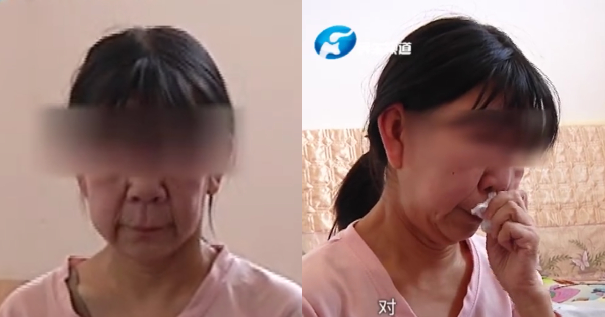 柯凱因氏症候群,皮膚鬆弛症,早衰