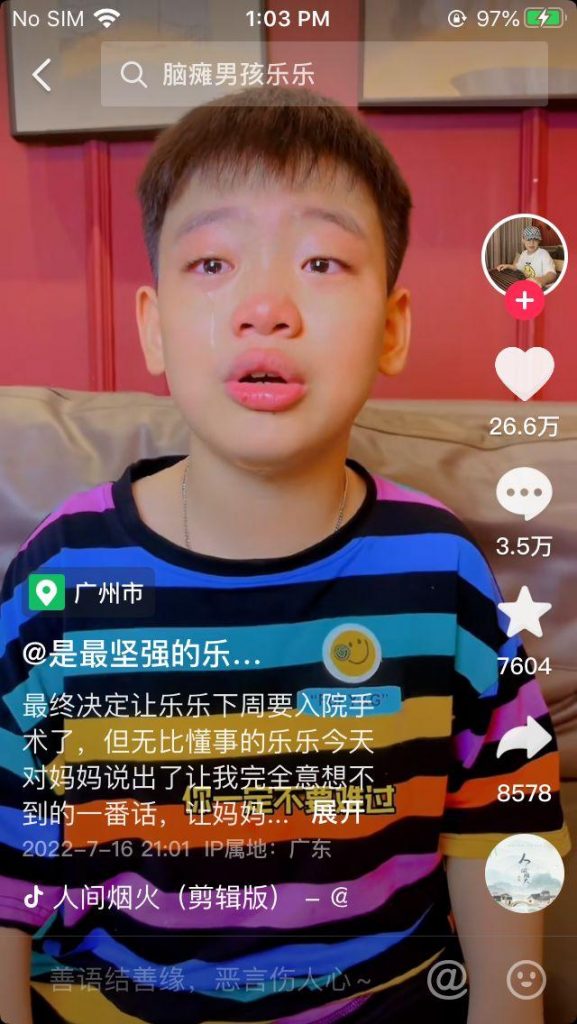 腦癱,抖音,手術